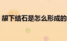 龈下结石是怎么形成的（结石是怎么形成的）