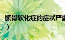 髌骨软化症的症状严重吗（髌骨软化症的症状）