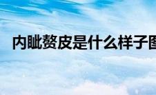 内眦赘皮是什么样子图片（内眦赘皮图片）
