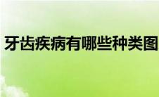 牙齿疾病有哪些种类图片（牙齿疾病有哪些）
