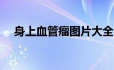 身上血管瘤图片大全（血管瘤图片大全）